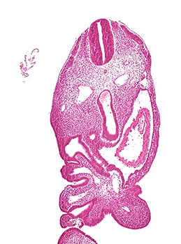 A histology section of a human embryo