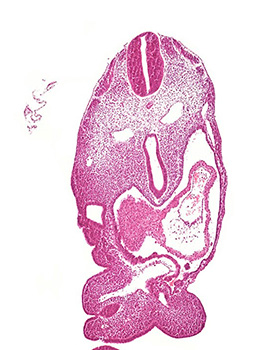 A histology section of a human embryo