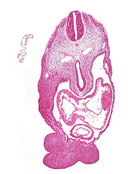 A histology section of a human embryo