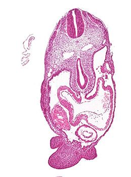 A histology section of a human embryo
