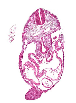 A histology section of a human embryo