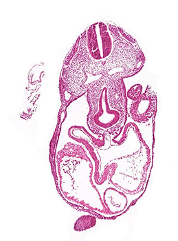 A histology section of a human embryo