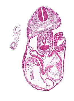 A histology section of a human embryo