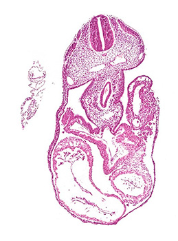 A histology section of a human embryo