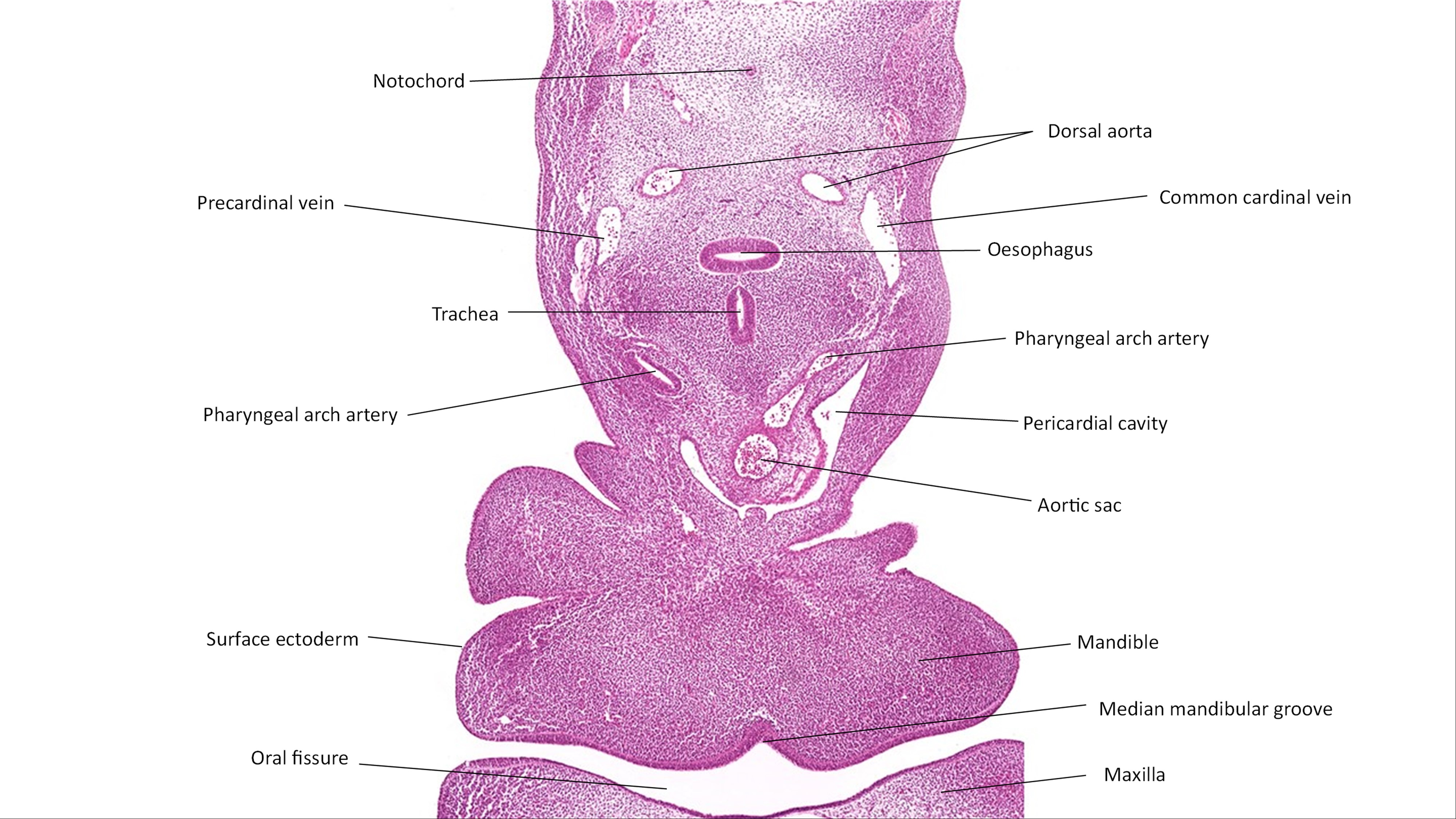 A histology section of a human embryo