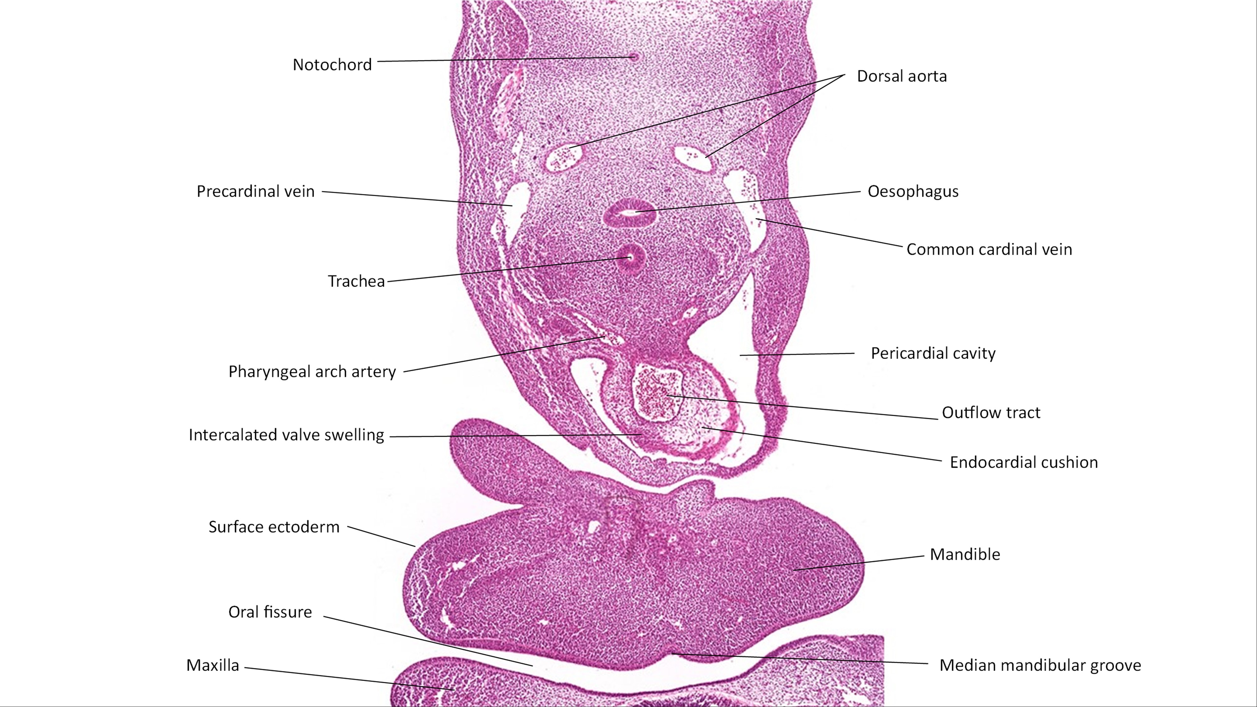 A histology section of a human embryo