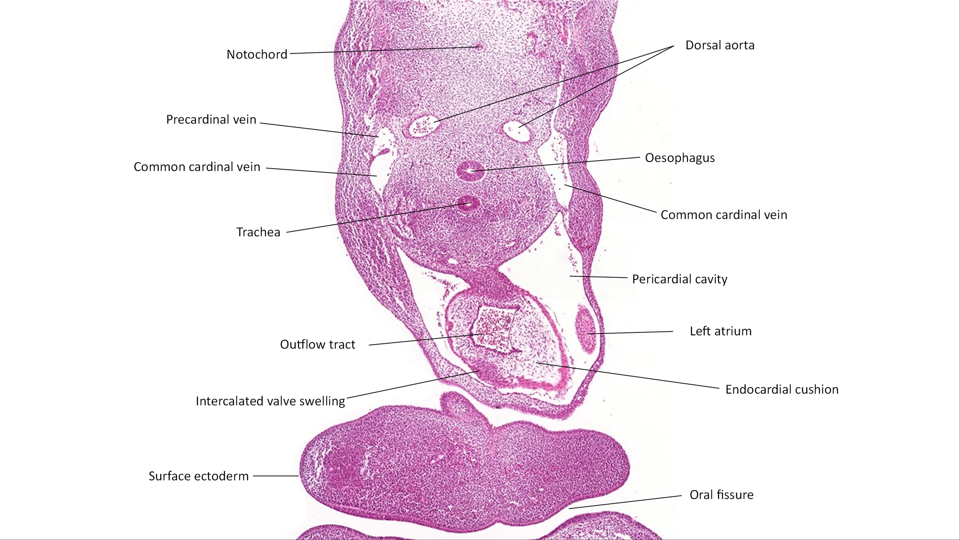 A histology section of a human embryo