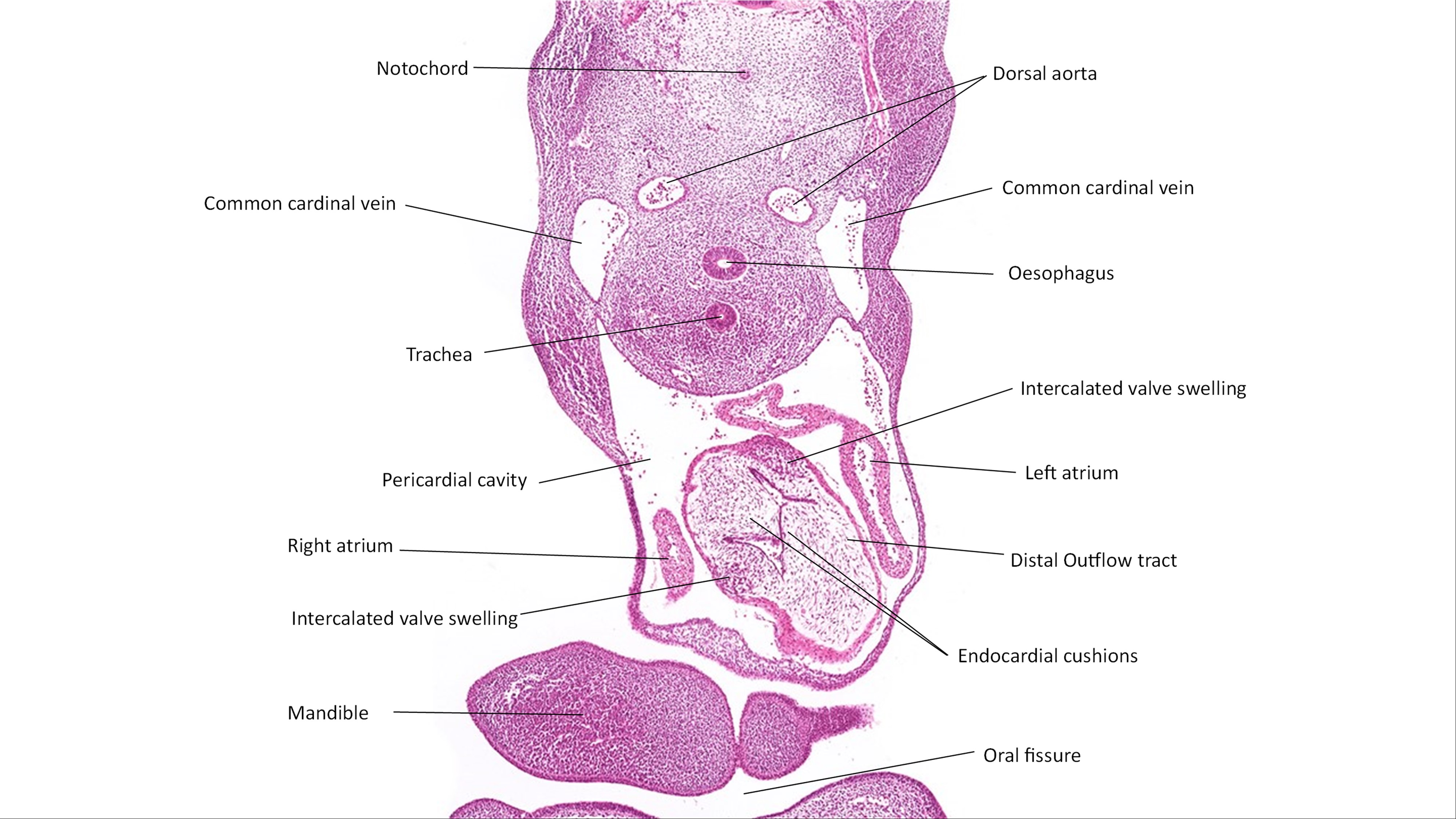 A histology section of a human embryo