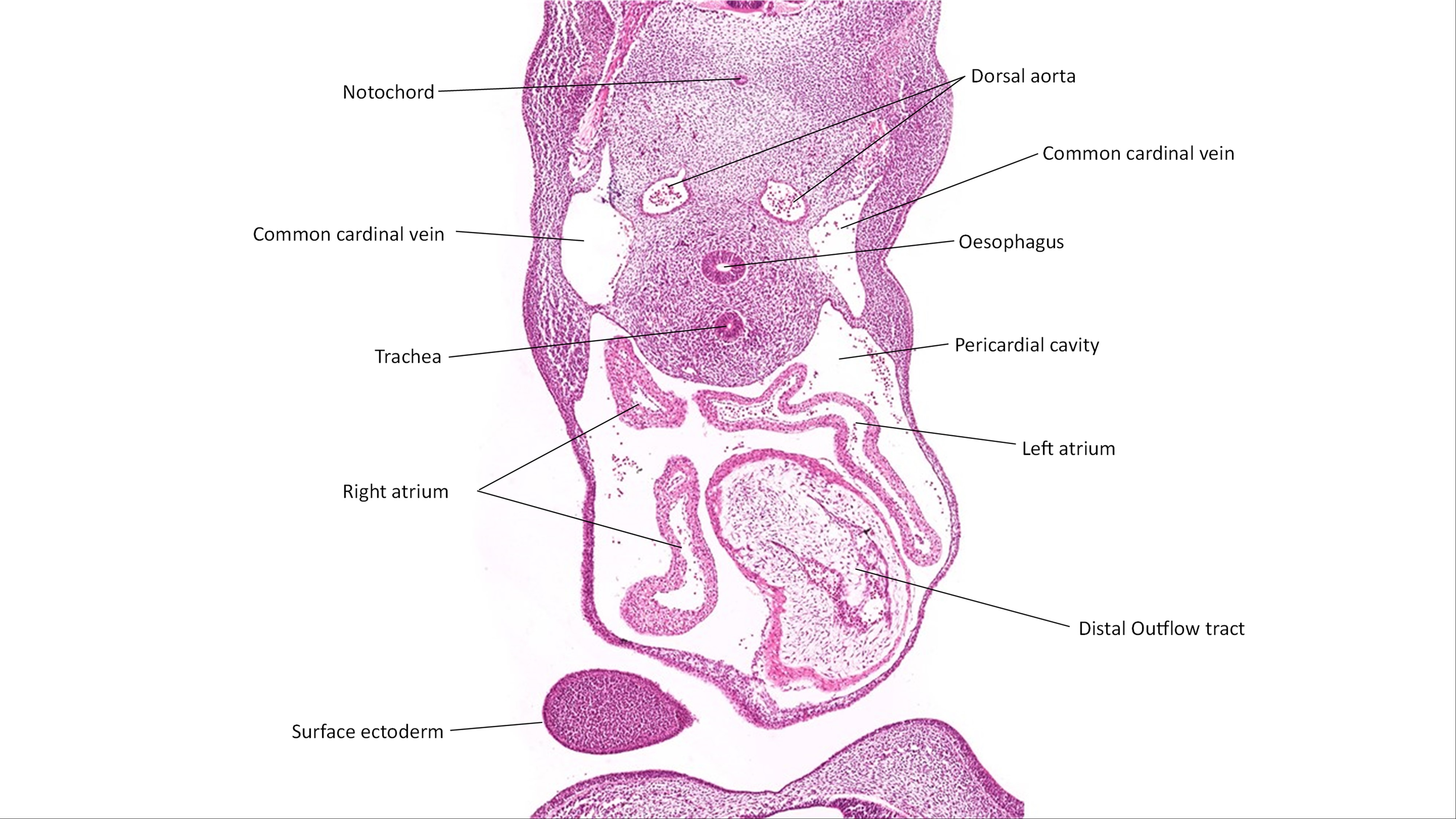 A histology section of a human embryo