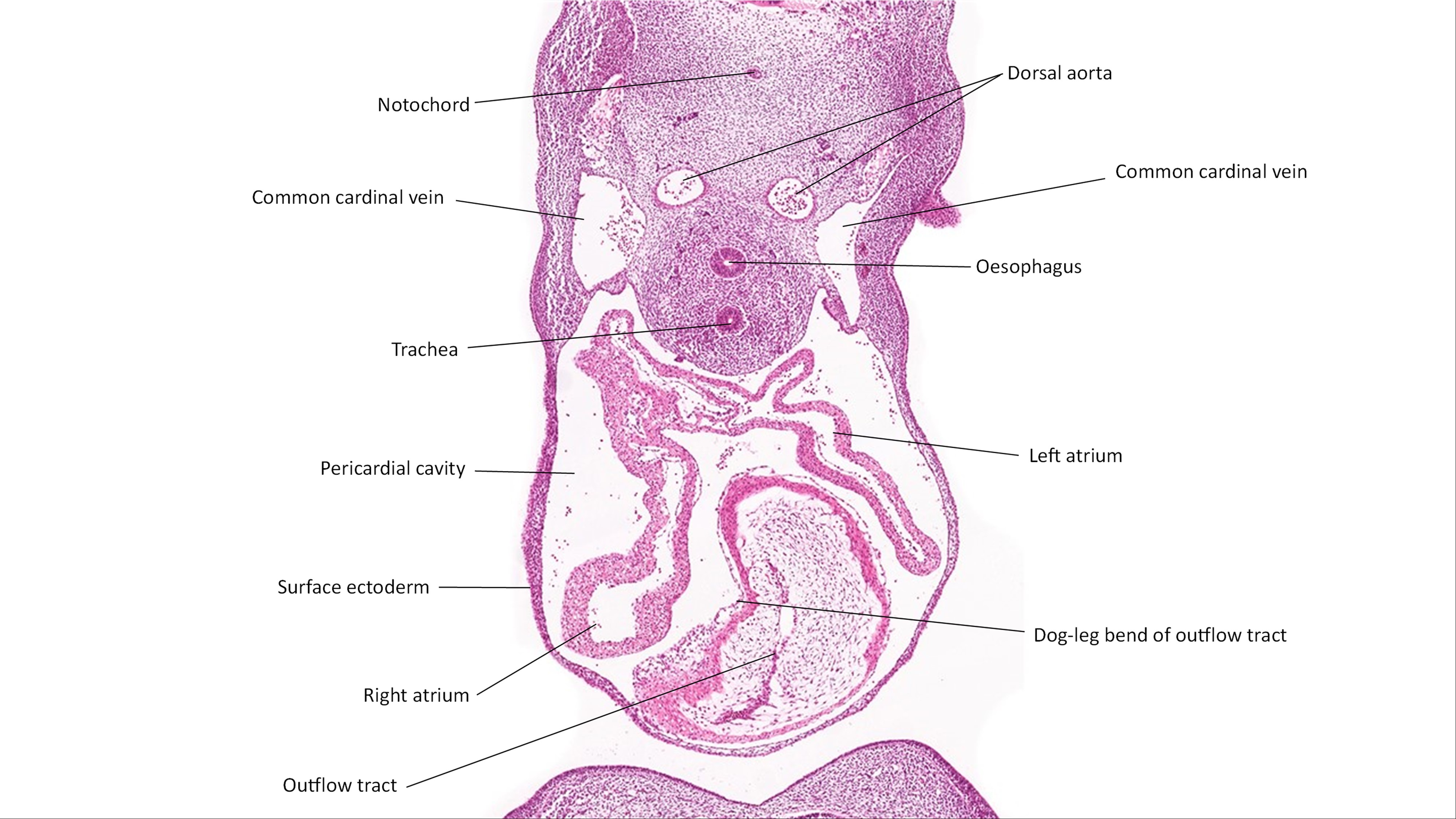 A histology section of a human embryo