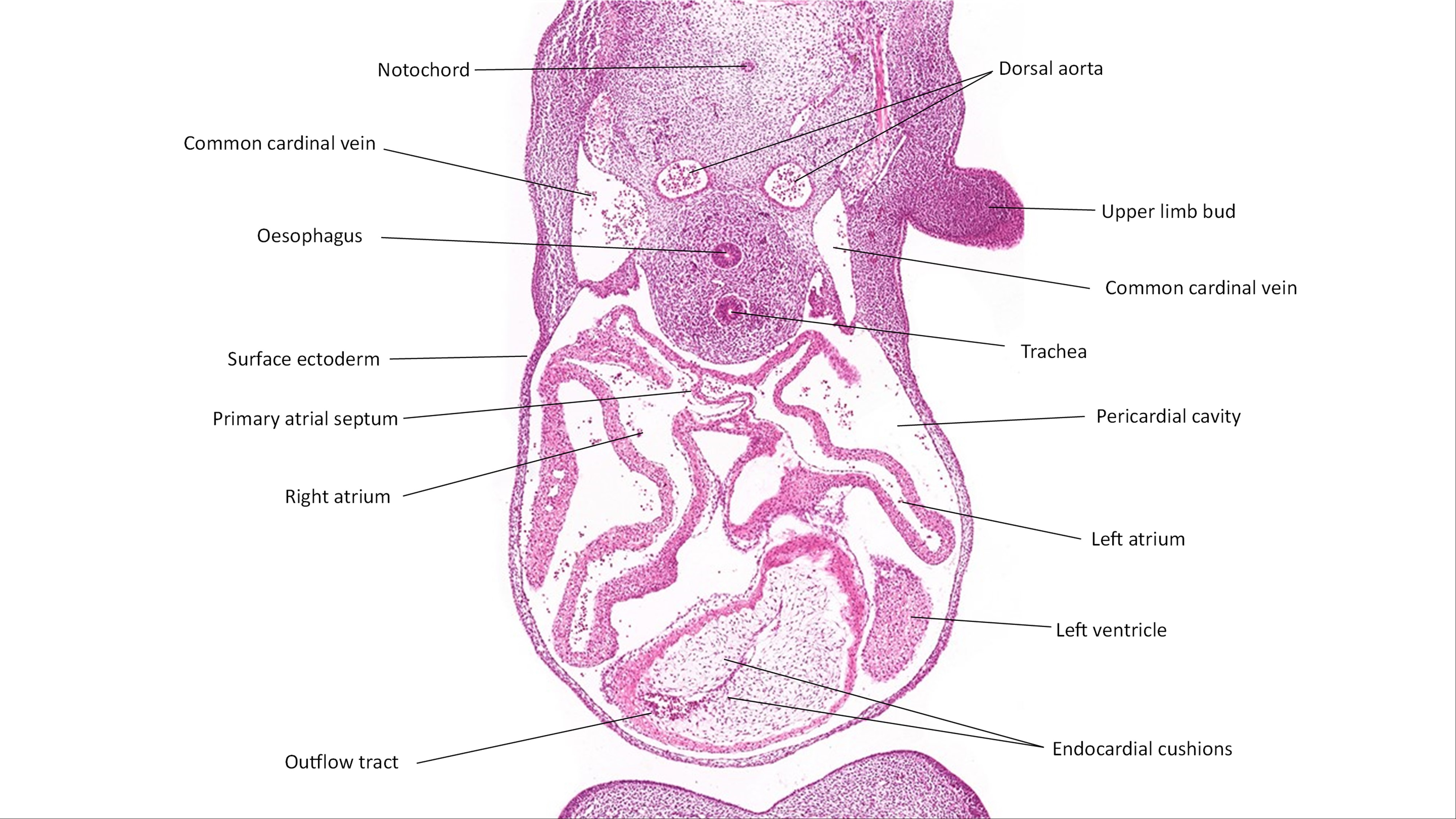 A histology section of a human embryo
