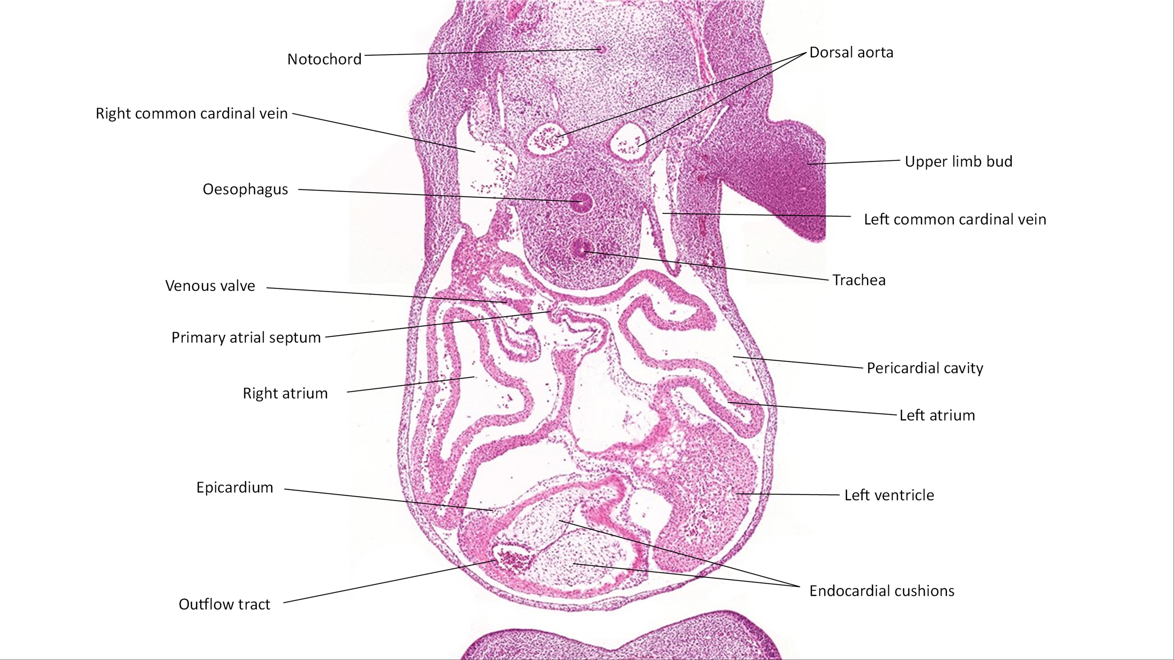 A histology section of a human embryo