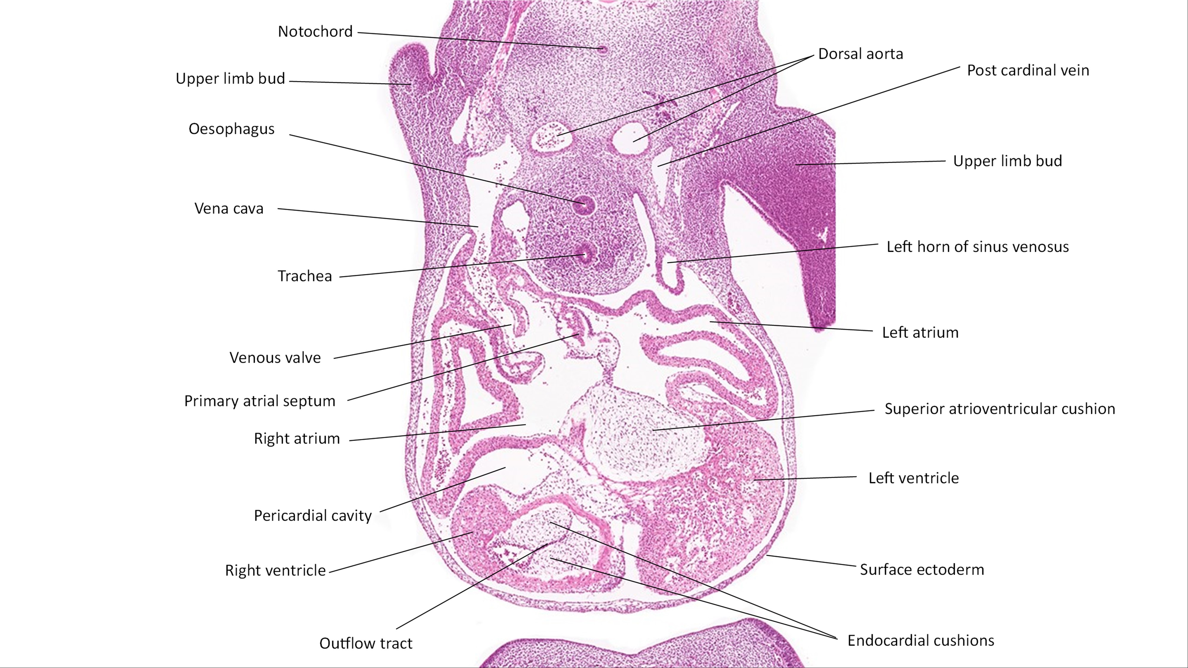 A histology section of a human embryo