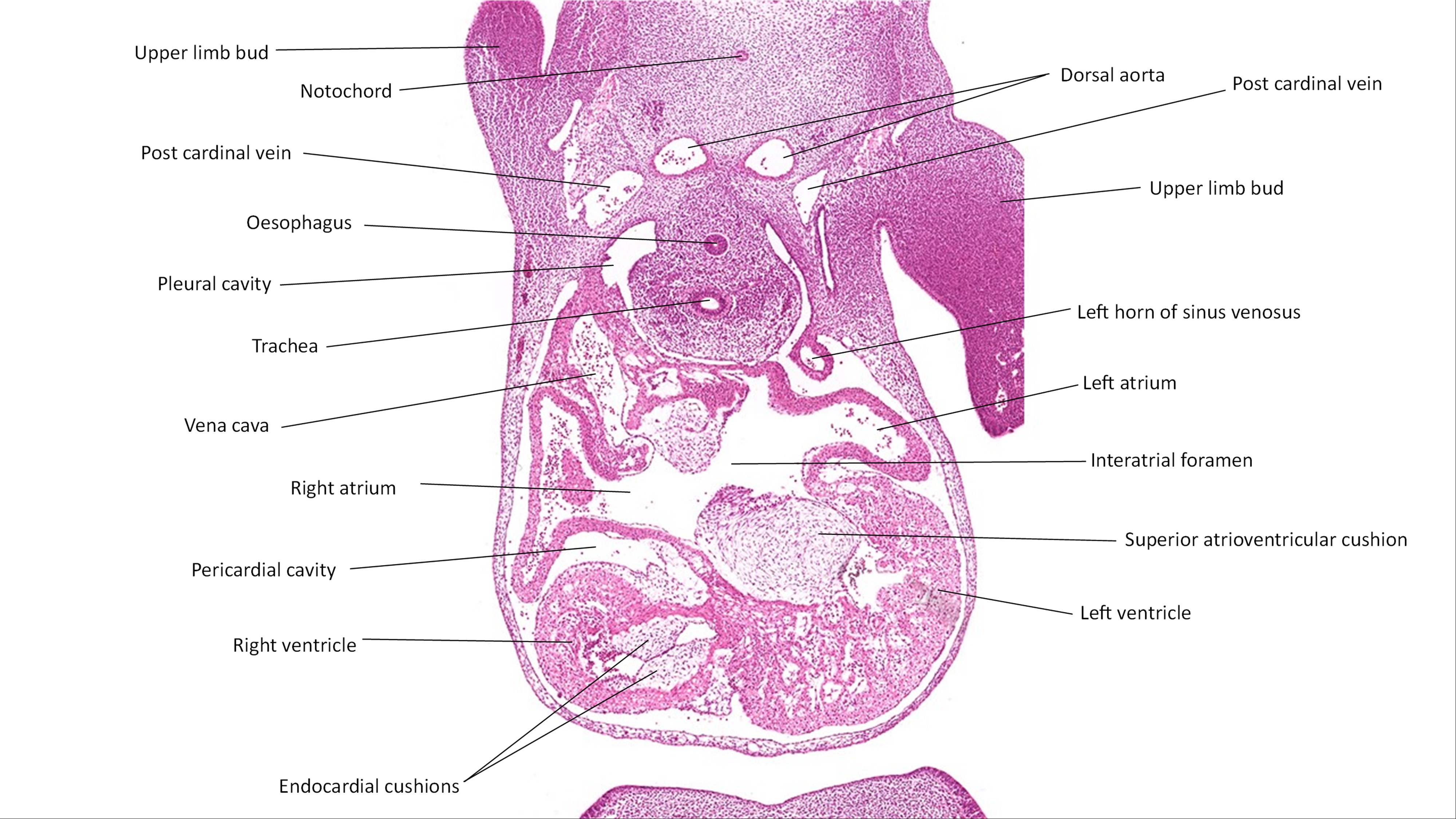 A histology section of a human embryo