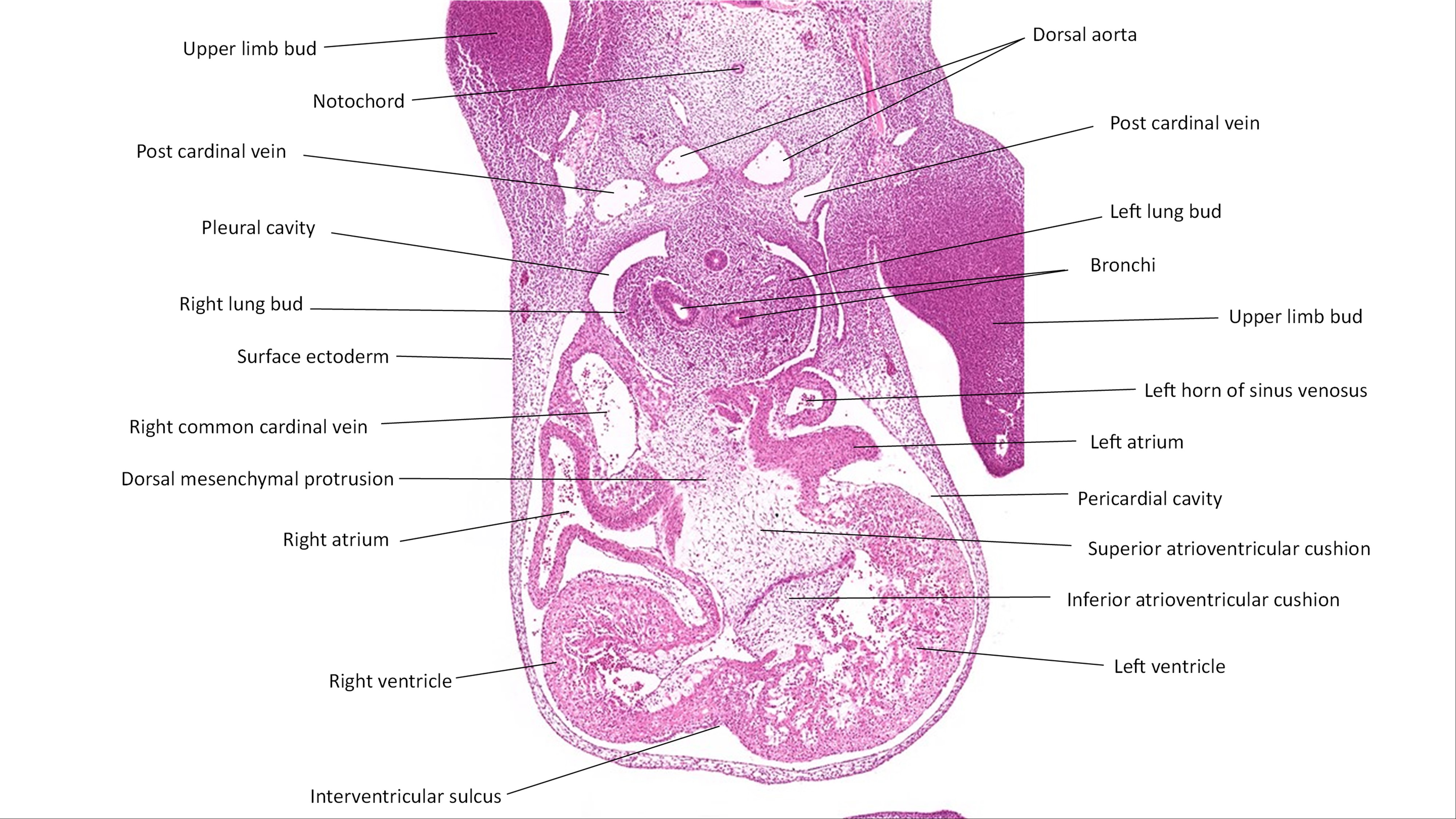 A histology section of a human embryo