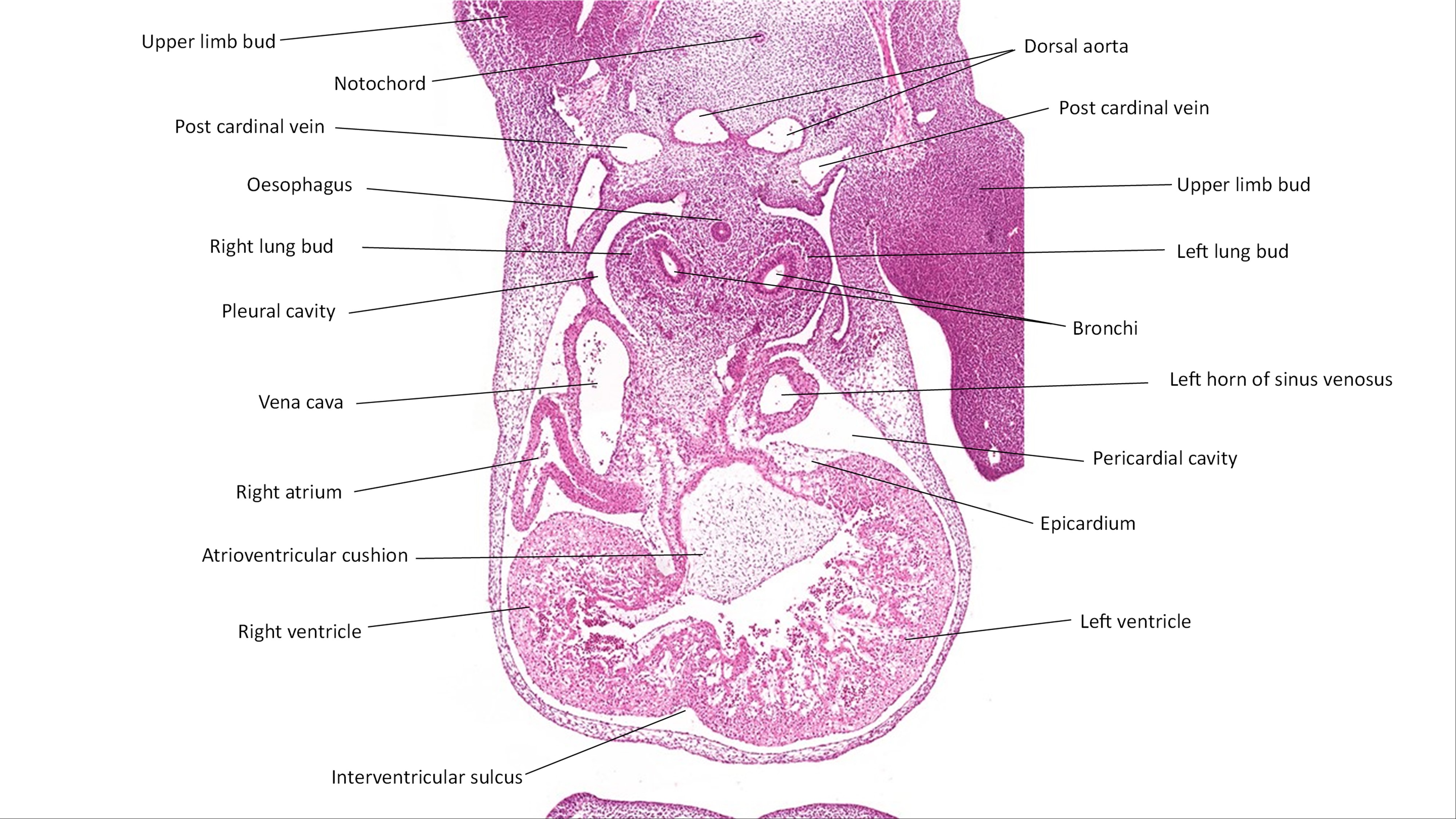 A histology section of a human embryo