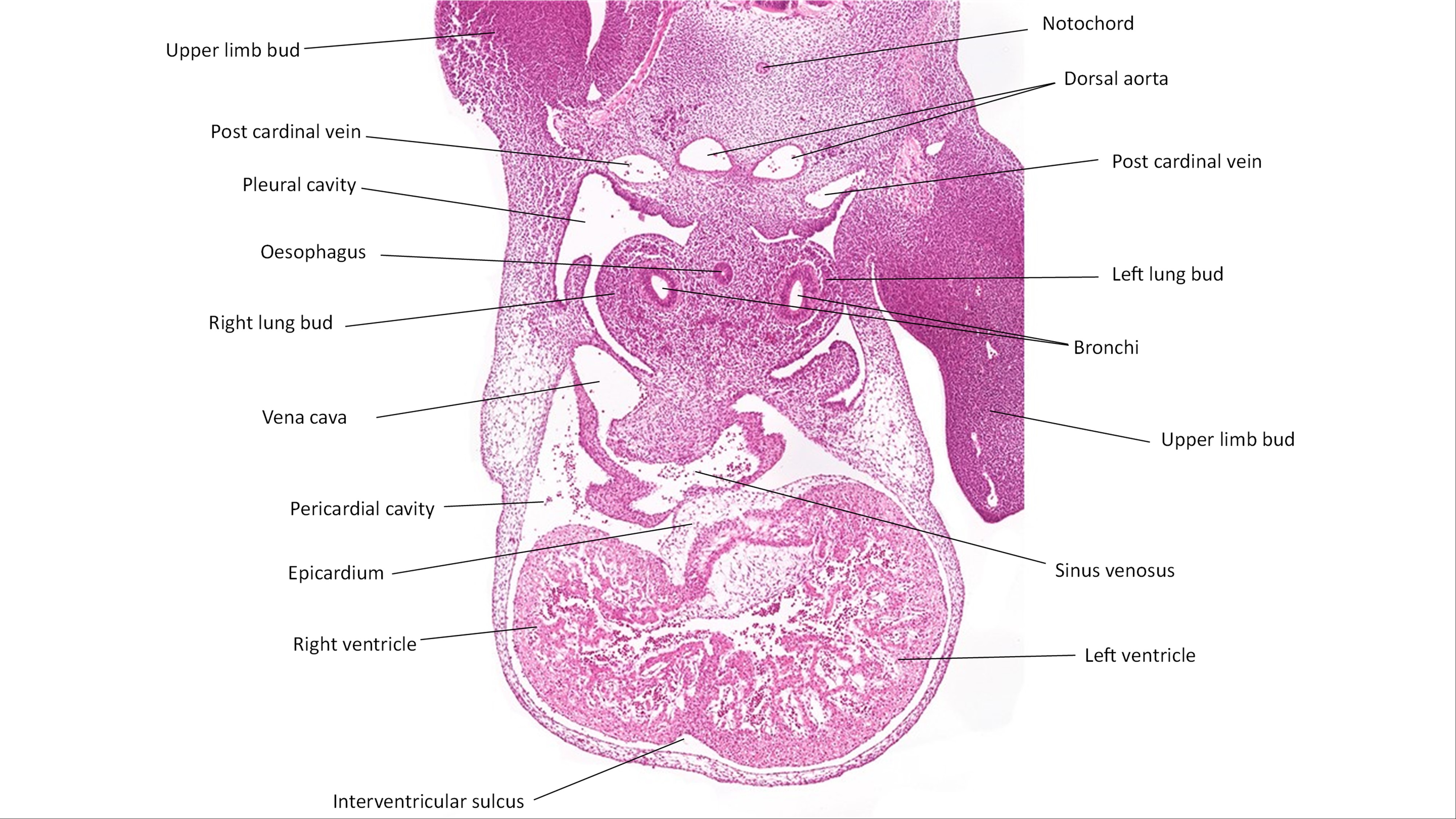 A histology section of a human embryo