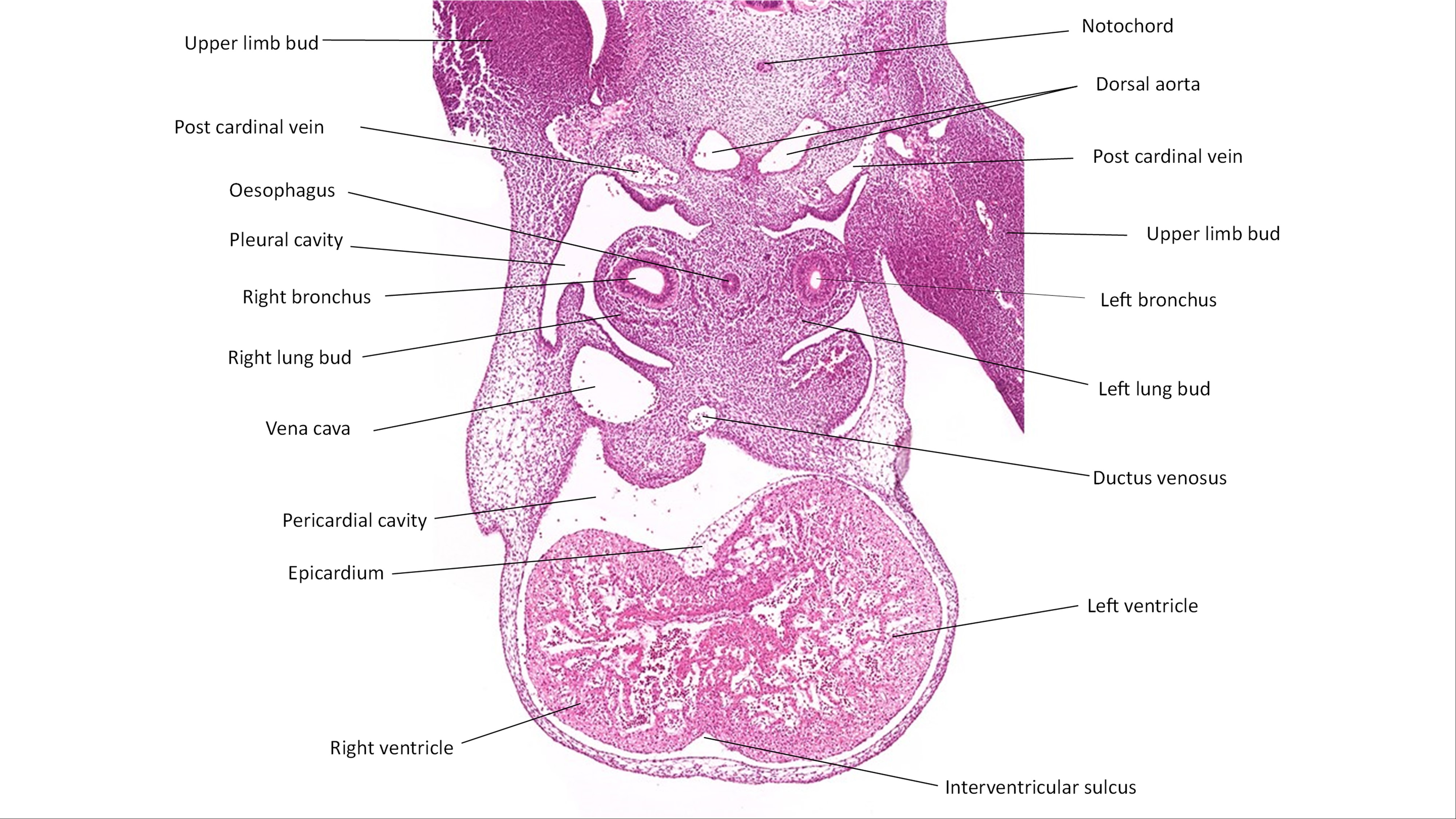 A histology section of a human embryo