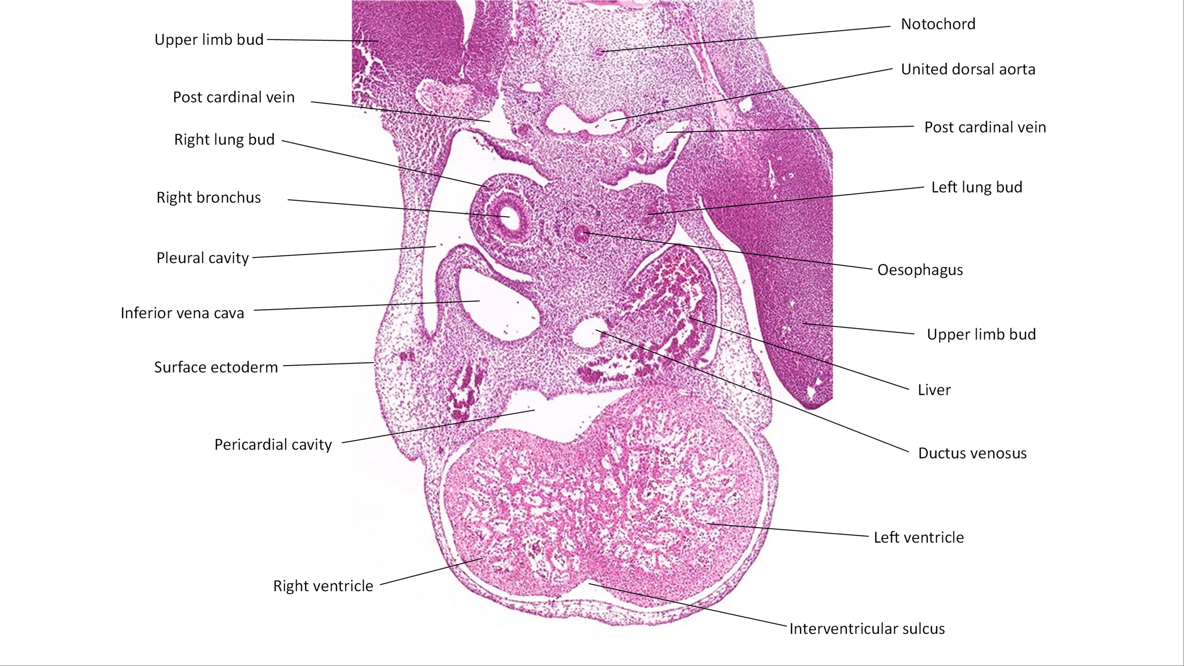 A histology section of a human embryo