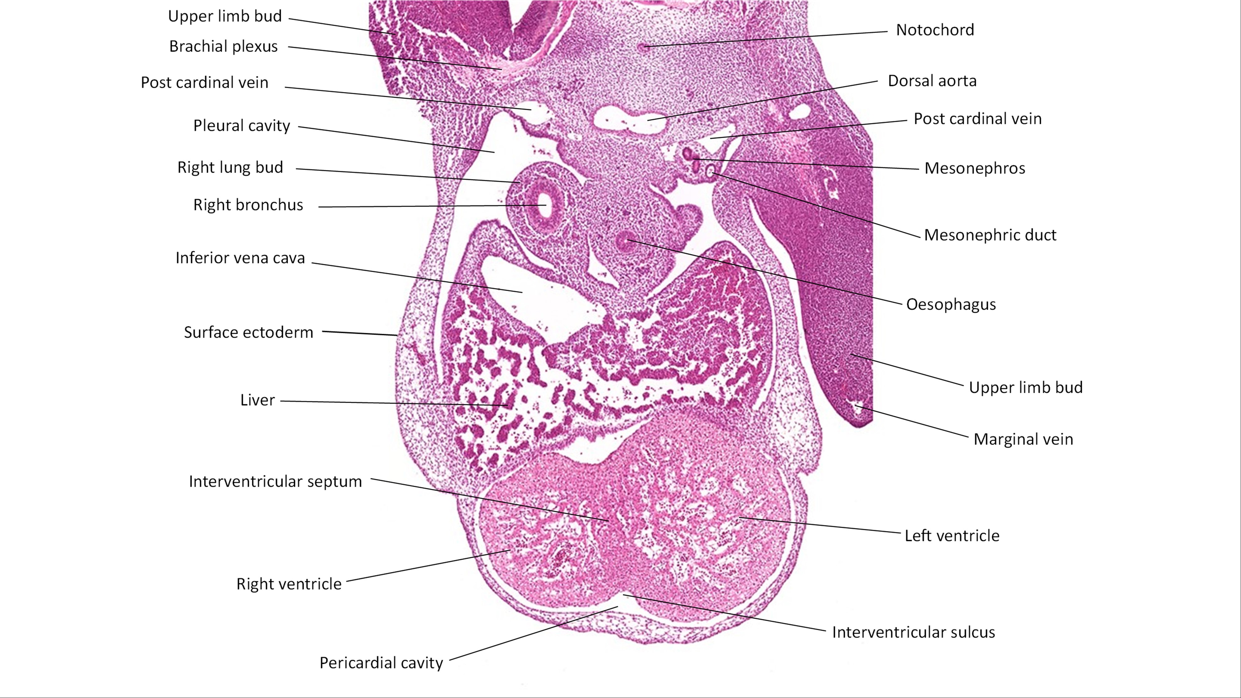 A histology section of a human embryo