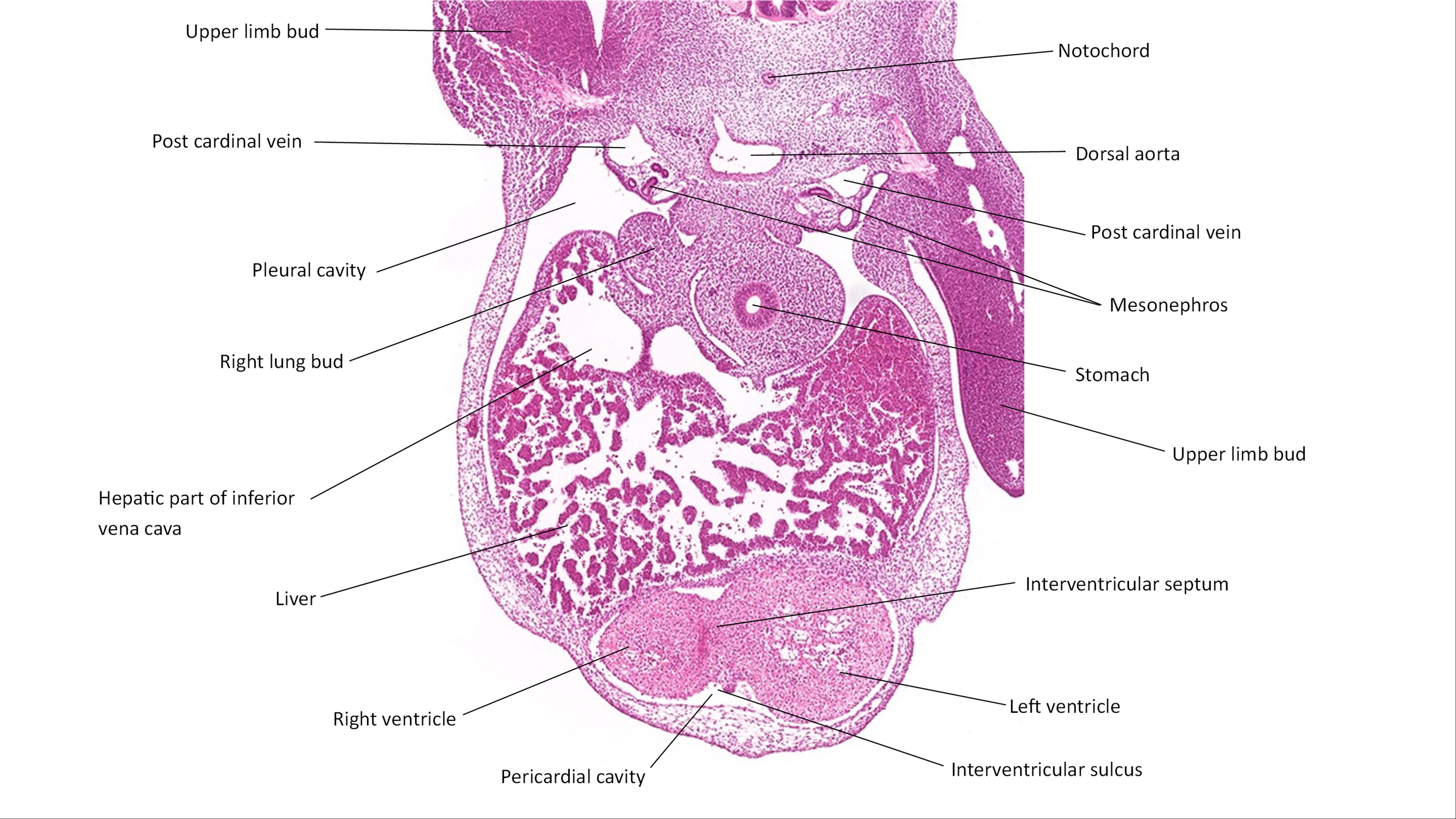 A histology section of a human embryo