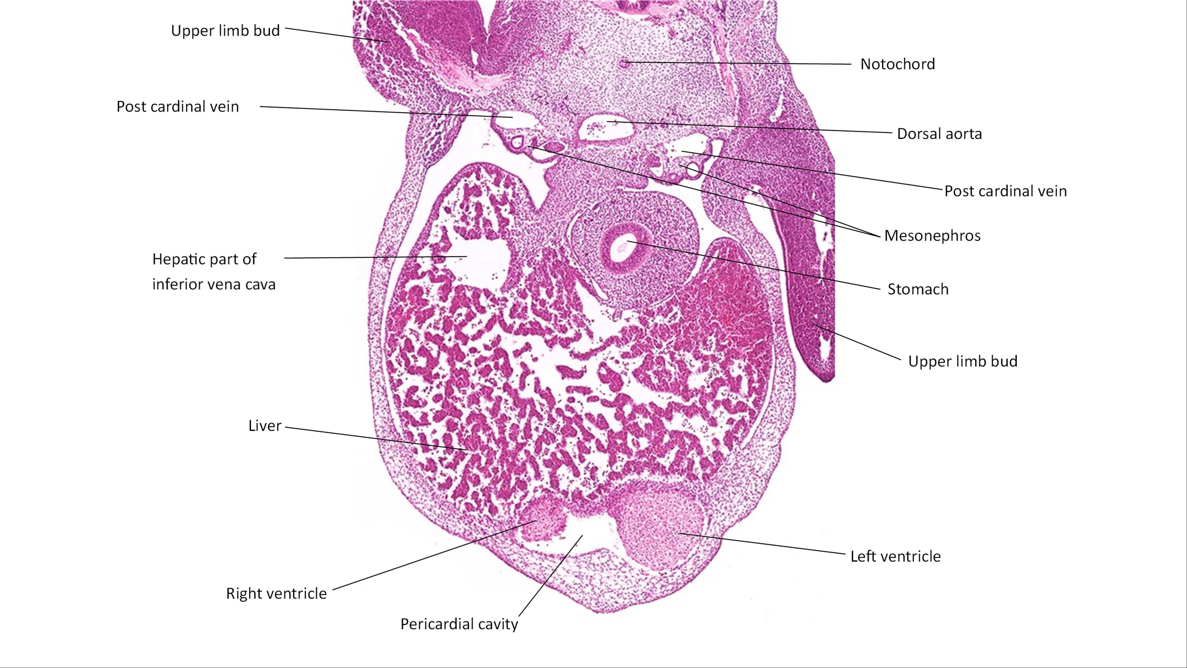 A histology section of a human embryo