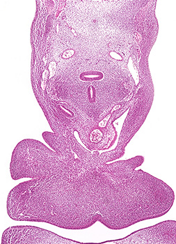 A histology section of a human embryo