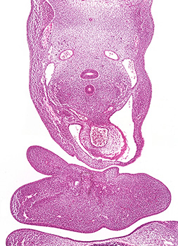 A histology section of a human embryo