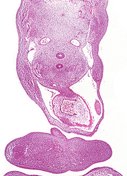 A histology section of a human embryo