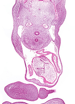 A histology section of a human embryo