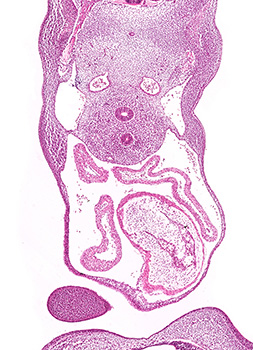 A histology section of a human embryo