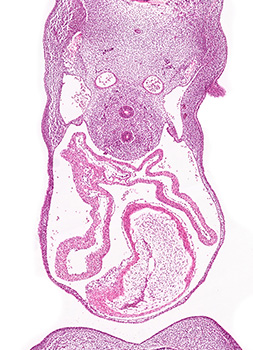 A histology section of a human embryo