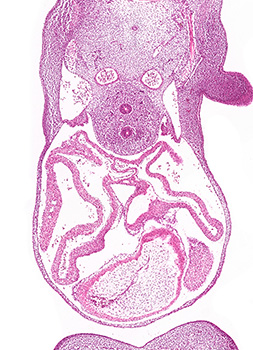 A histology section of a human embryo