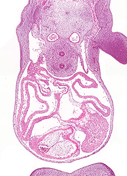A histology section of a human embryo
