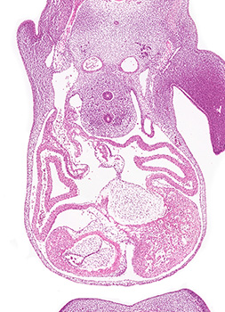 A histology section of a human embryo
