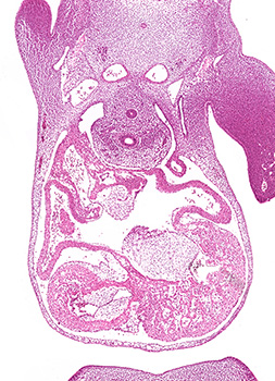 A histology section of a human embryo