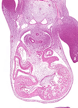 A histology section of a human embryo