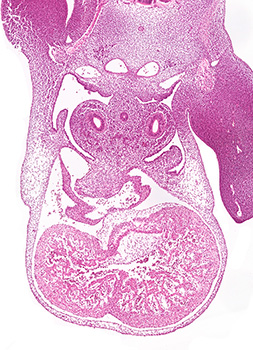A histology section of a human embryo