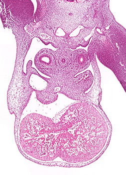 A histology section of a human embryo