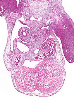 A histology section of a human embryo