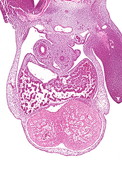 A histology section of a human embryo