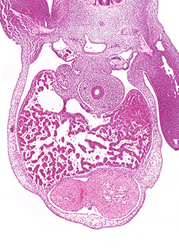 A histology section of a human embryo