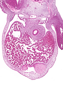 A histology section of a human embryo