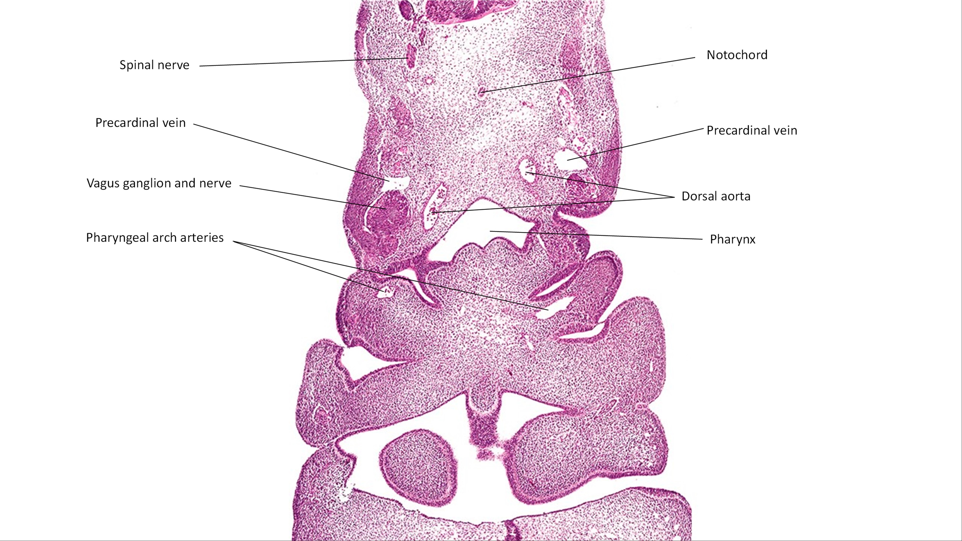A histology section of a human embryo