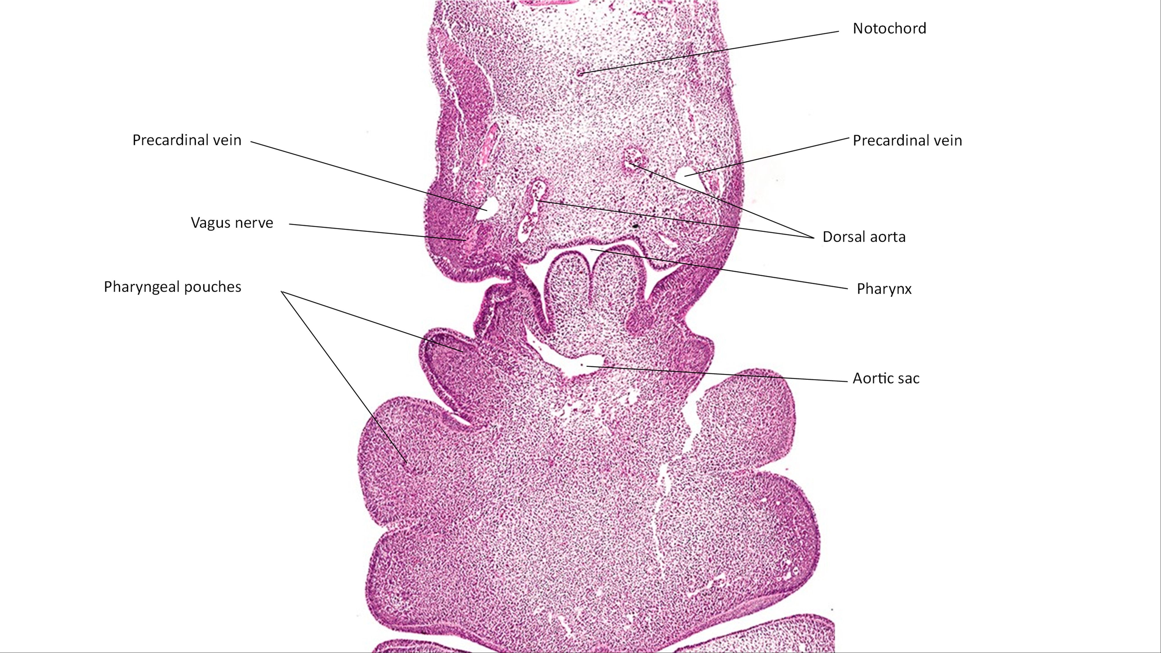 A histology section of a human embryo