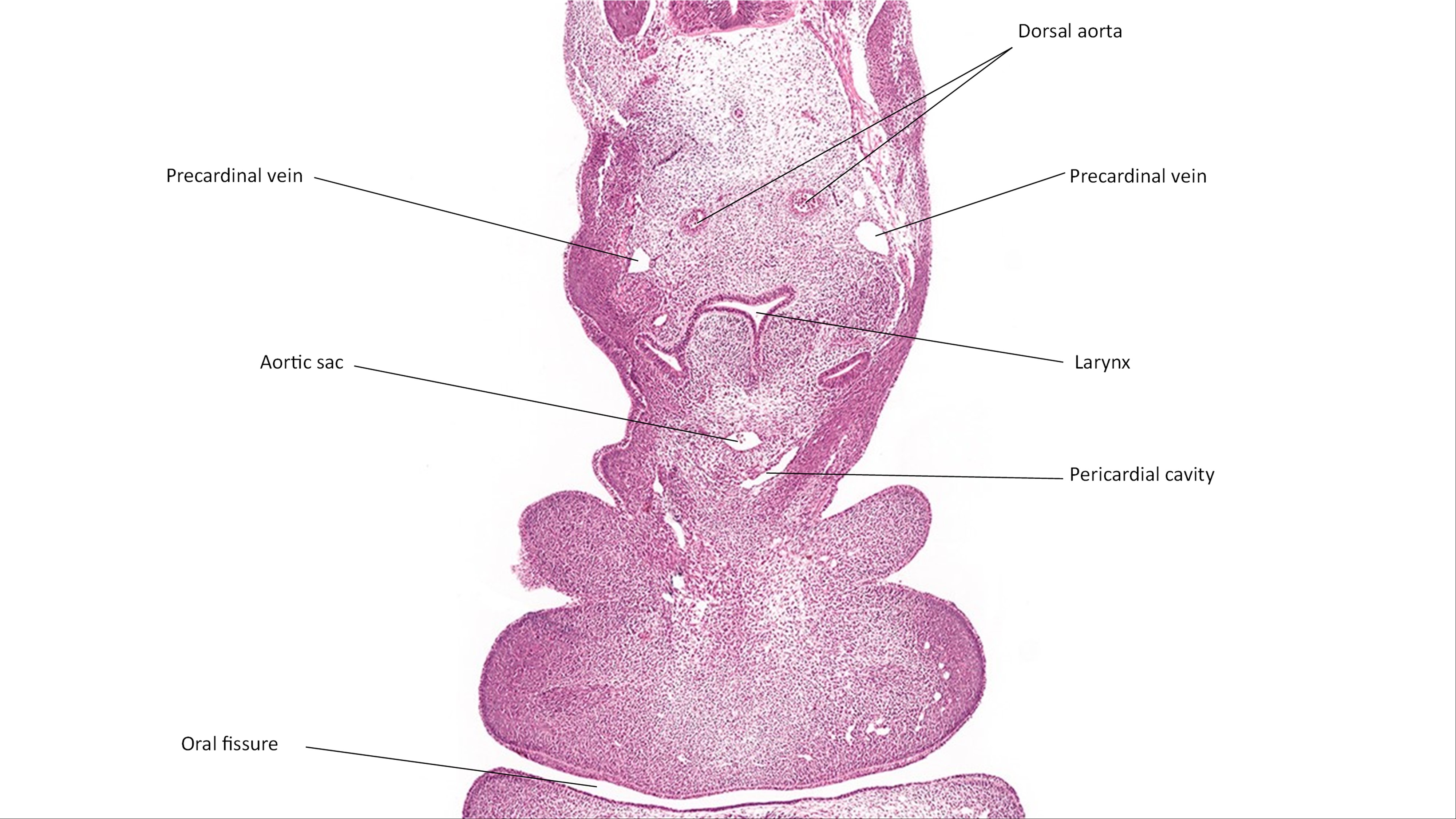 A histology section of a human embryo