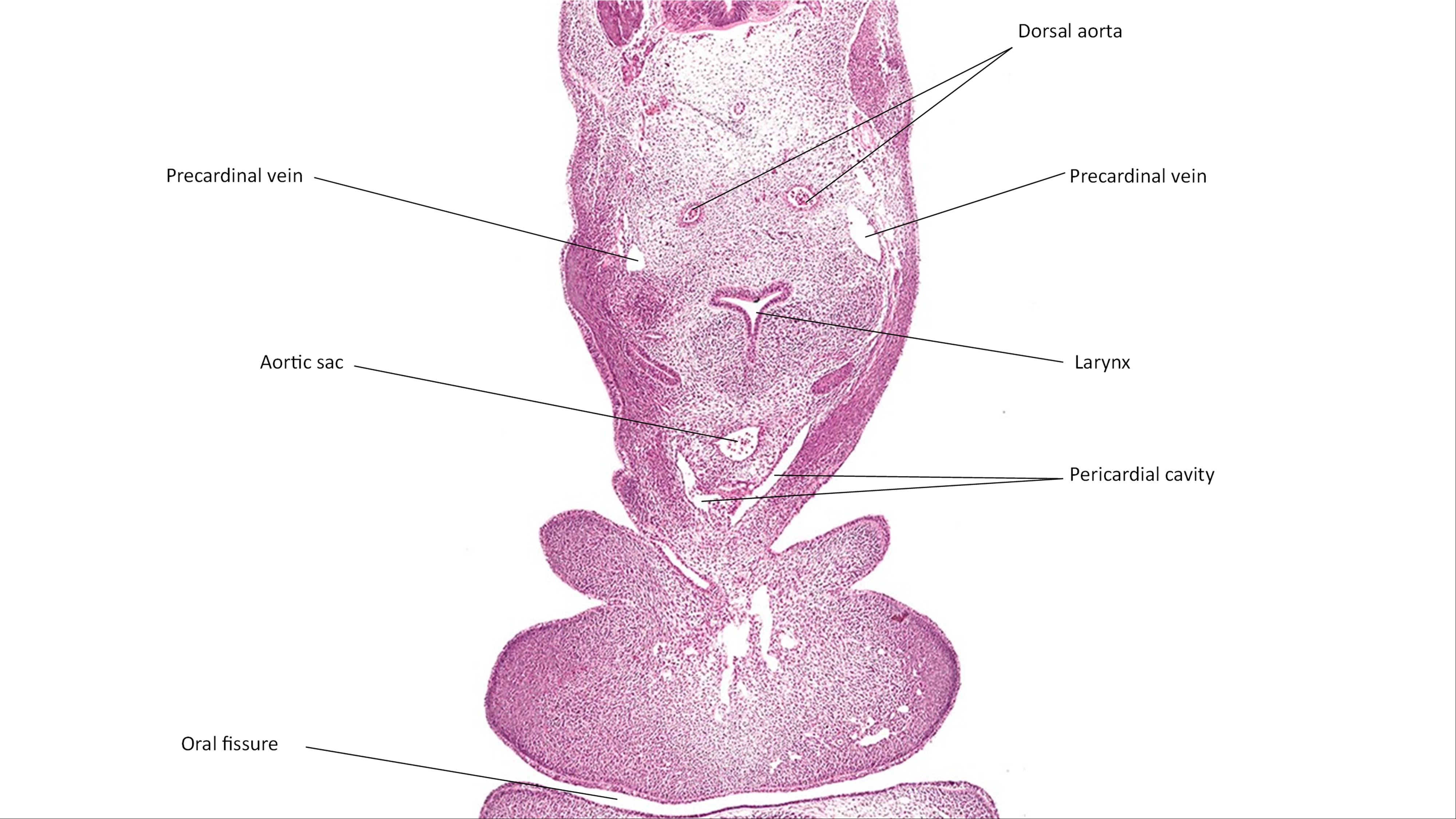 A histology section of a human embryo