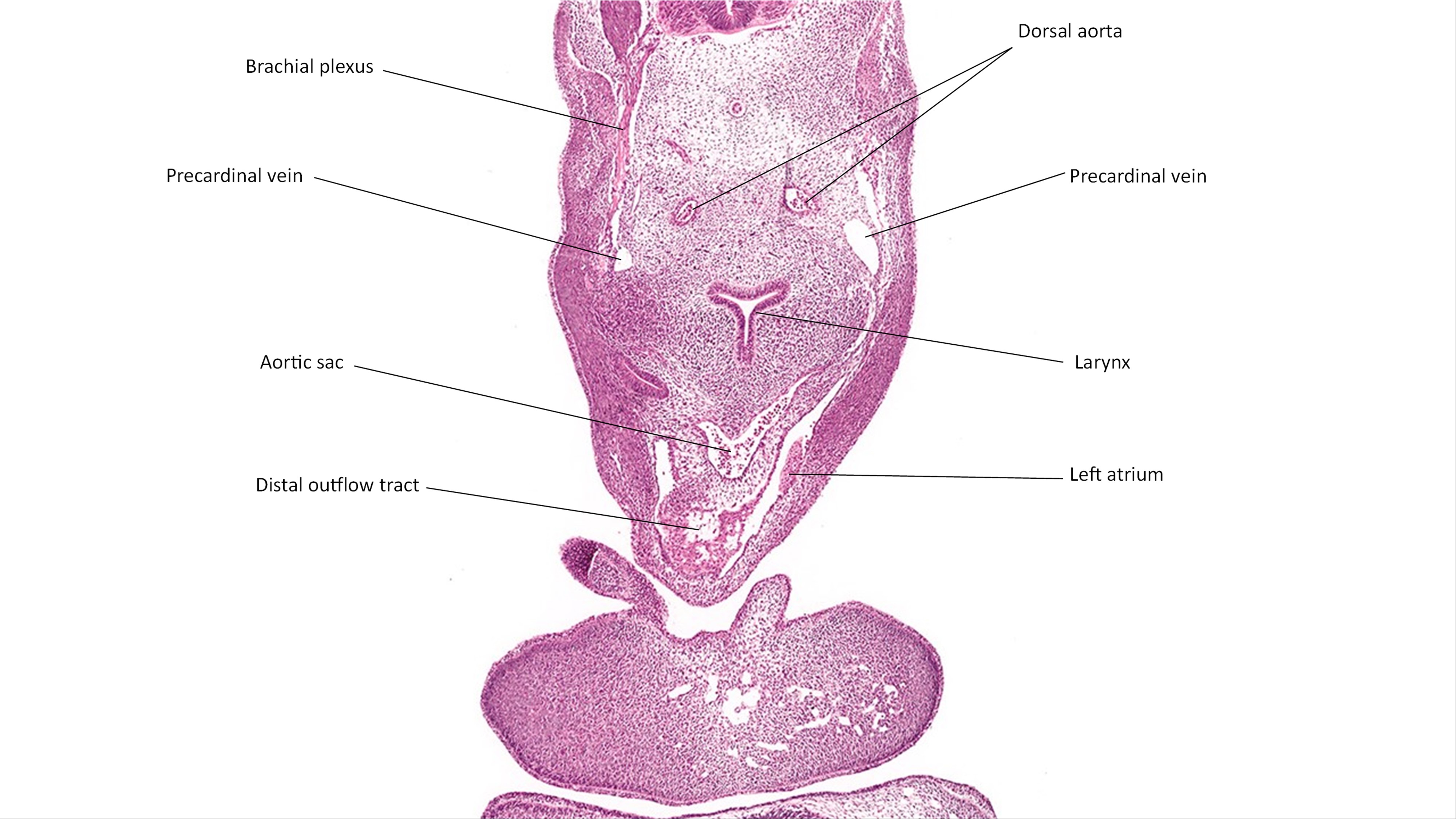A histology section of a human embryo
