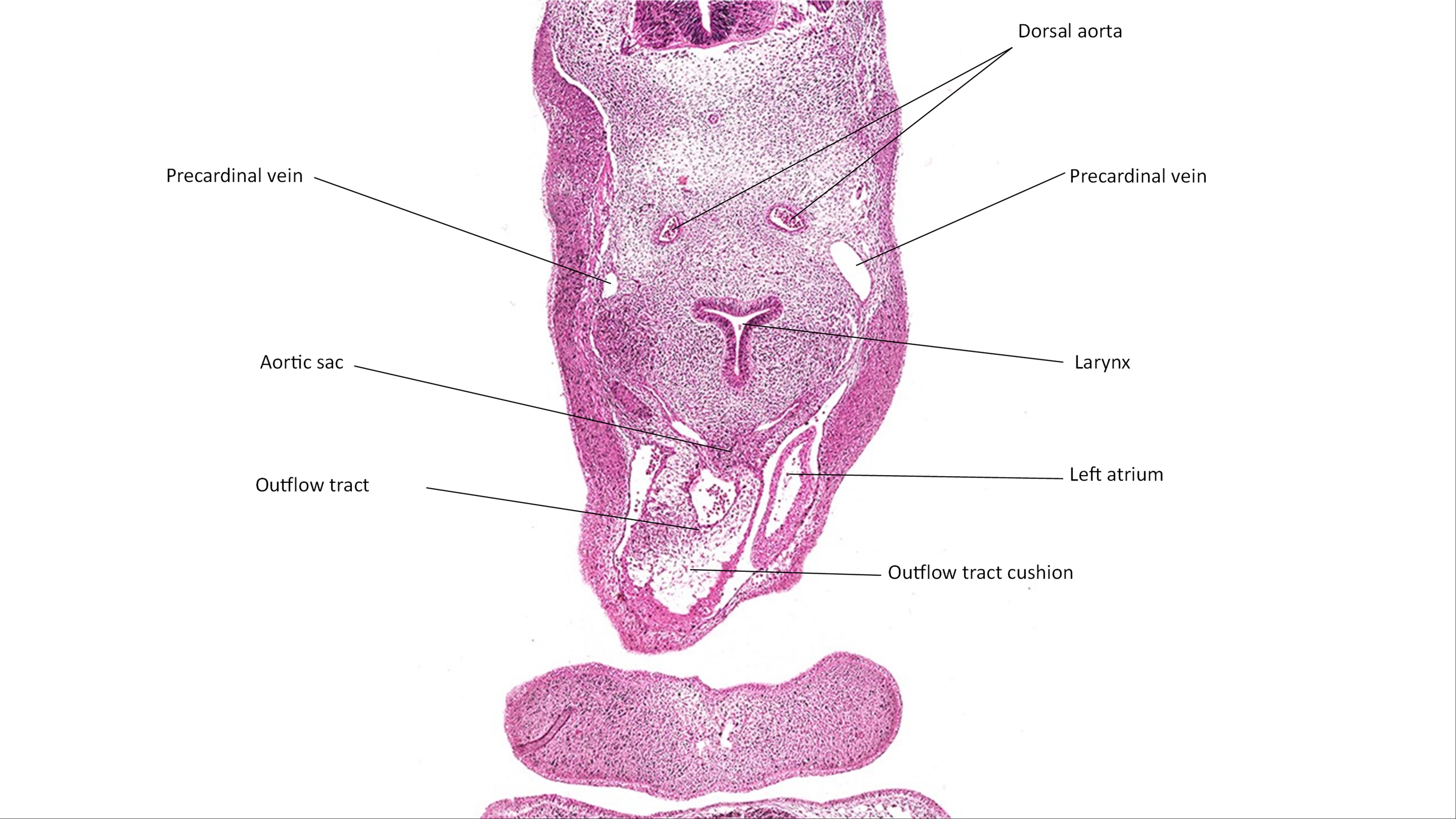 A histology section of a human embryo