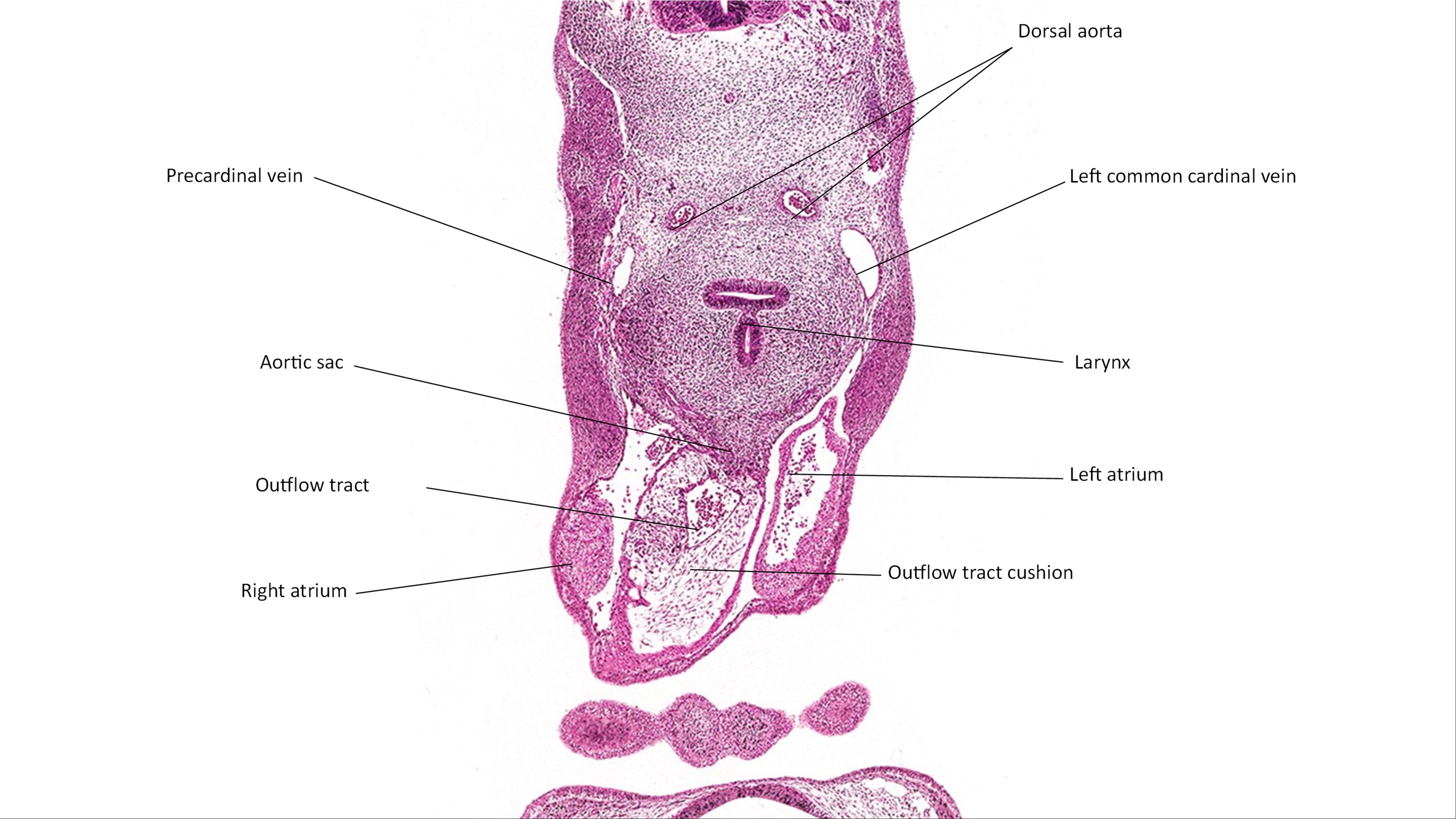 A histology section of a human embryo